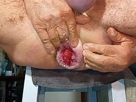 扩肛侠2025-14 chinese teenage gay porn