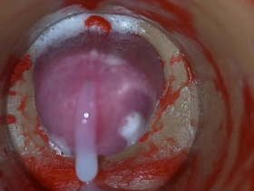 内射实录——体内镜头捕捉男性深喉射精 gay korean twink porn