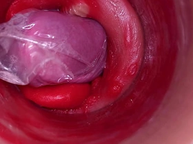 深入阴道的摄像头记录下带着套套的巨量射精 gay porn asia